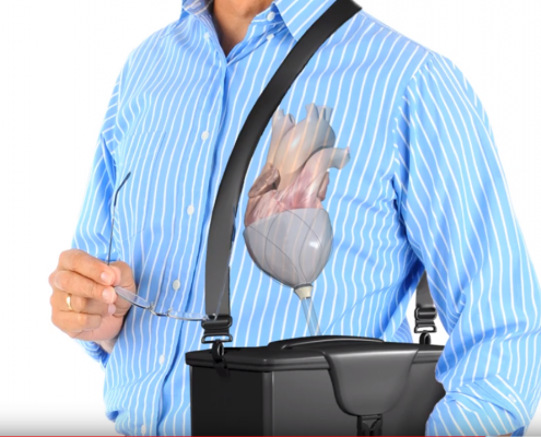 medical device 3D animation