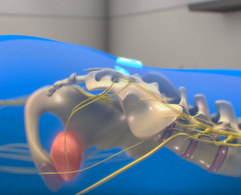 medical device animation